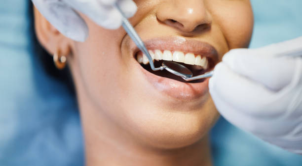 Best Lost Filling or Crown Replacement in Helmetta, NJ