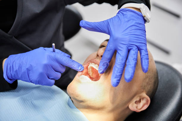 Best Emergency Wisdom Tooth Extraction in Helmetta, NJ