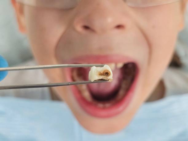 Best Emergency Treatment for Oral Infections in Helmetta, NJ